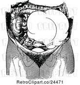 Vector Clip Art of Retro Ovarian Tumor on the Left Side of the Pelvis by Prawny Vintage