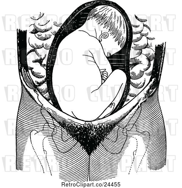 Vector Clip Art of Retro Baby in Breach Position