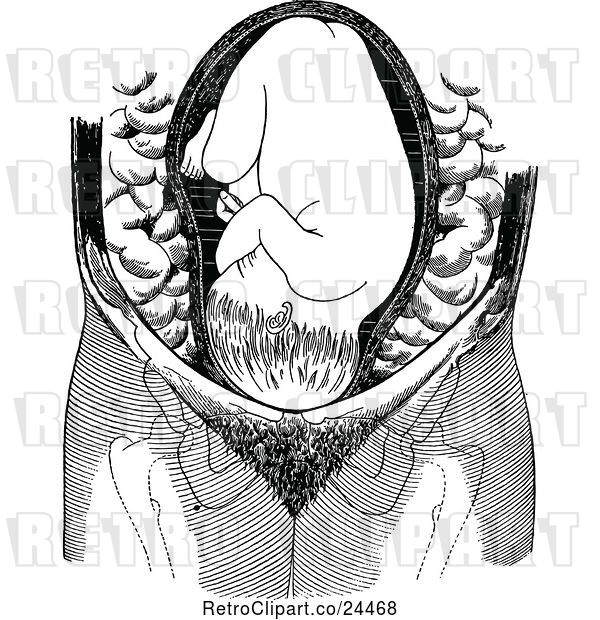 Vector Clip Art of Retro Baby in Cranial Position