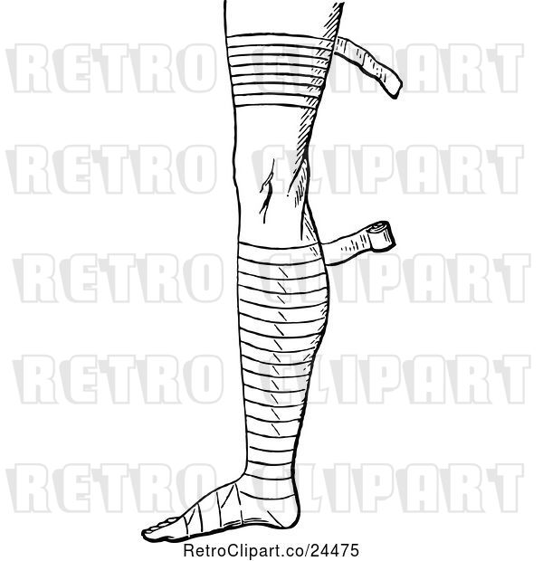 Vector Clip Art of Retro Bandaged Foot and Leg 2
