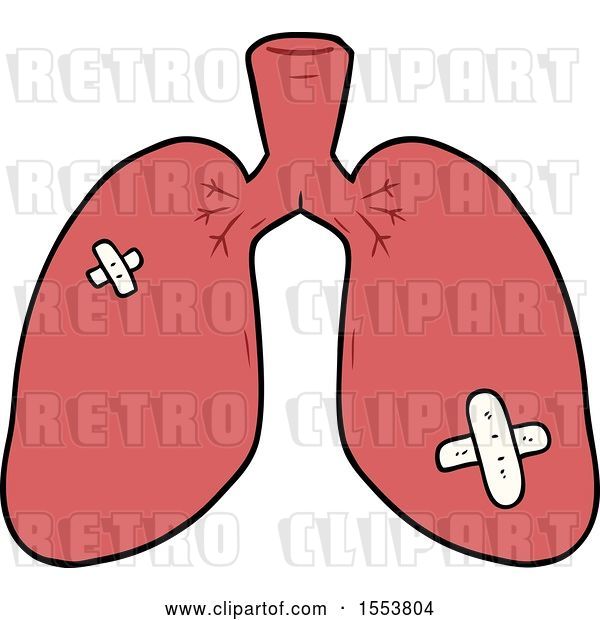 Vector Clip Art of Retro Cartoon Repaired Lungs