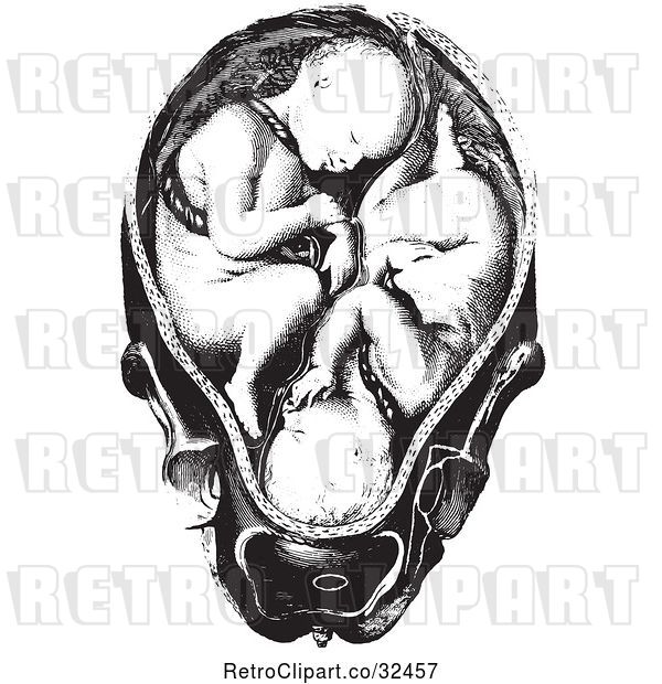 Vector Clip Art of Retro Twins in a Womb