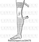 Vector Clip Art of Retro Bandaged Foot and Leg 2 by Prawny Vintage