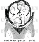 Vector Clip Art of Retro Uterus with Twins by Prawny Vintage