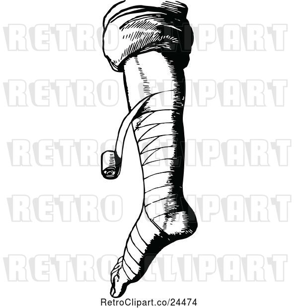 Vector Clip Art of Retro Bandaged Foot and Leg